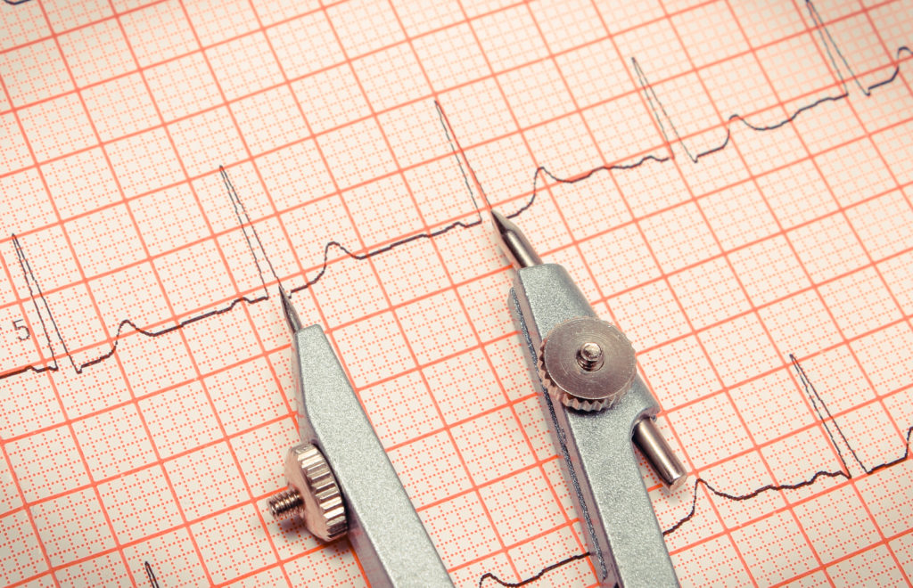 compass to measure ecg