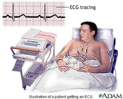 ElectrocardiographyECG