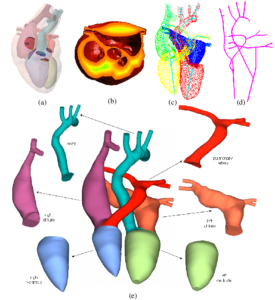 a-Template-model-of-human-heart