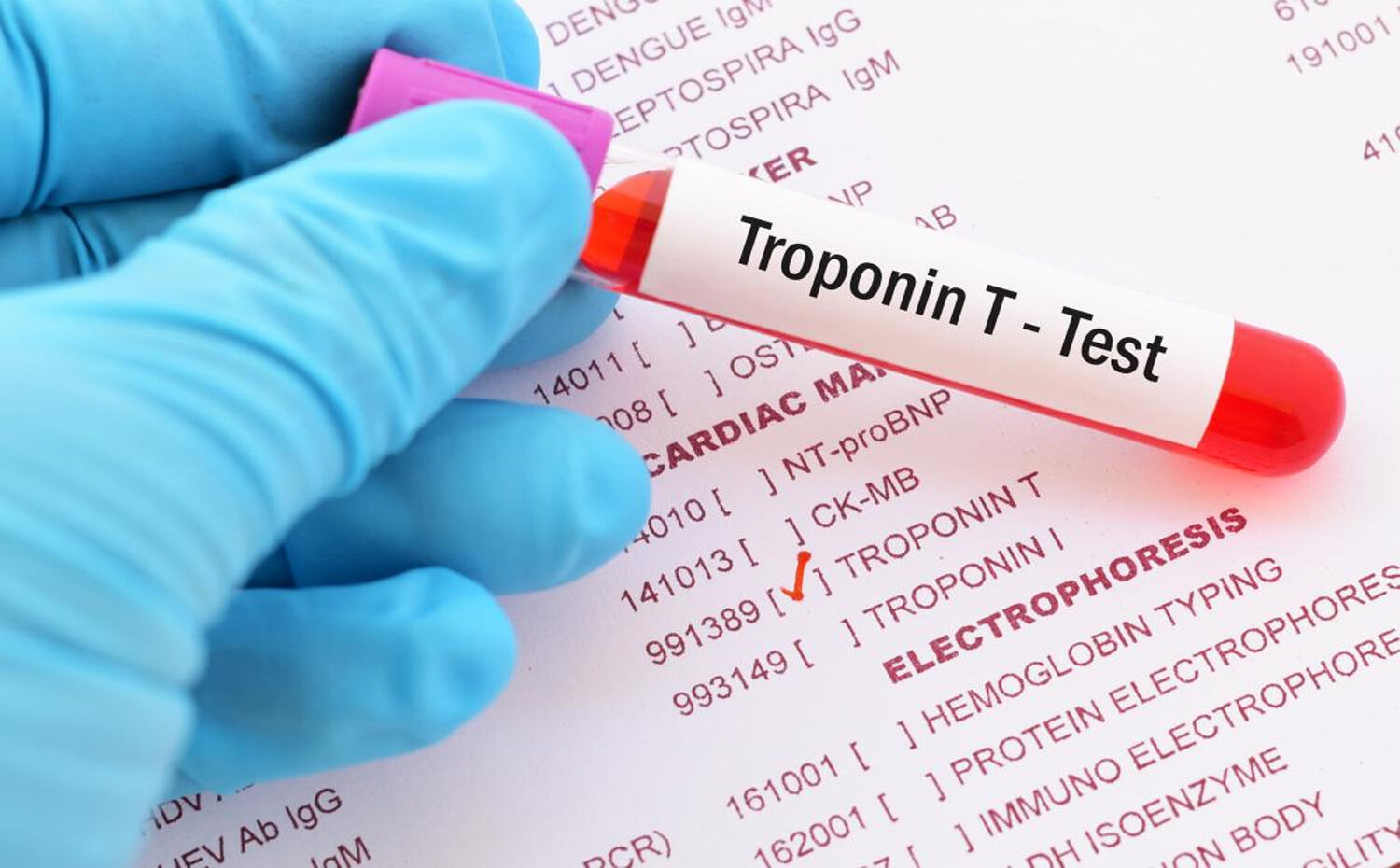 troponin-test
