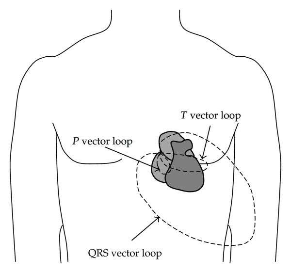 vectorcardiology loops